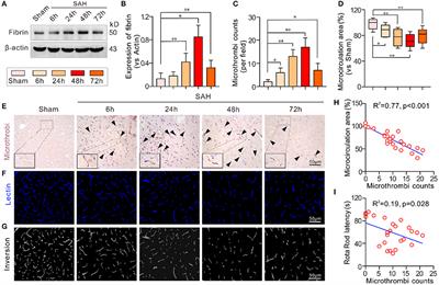 Association of Pericyte Loss With Microthrombosis After Subarachnoid Hemorrhage in ApoE-Deficient Mice